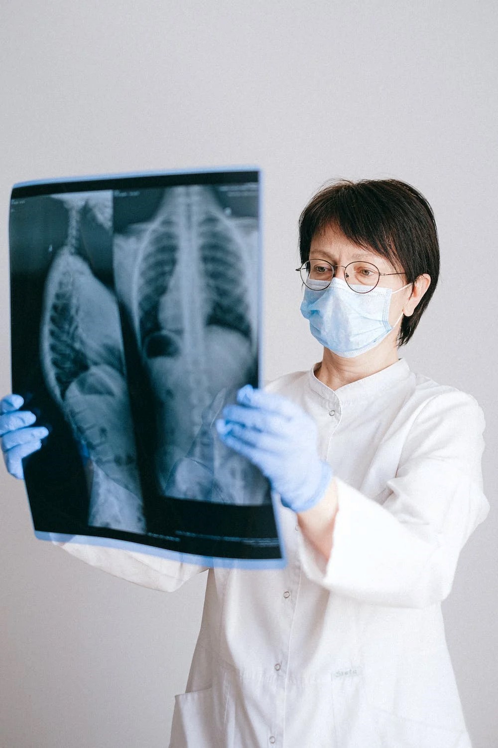 不抽菸、重養生，為何還會得肺癌？