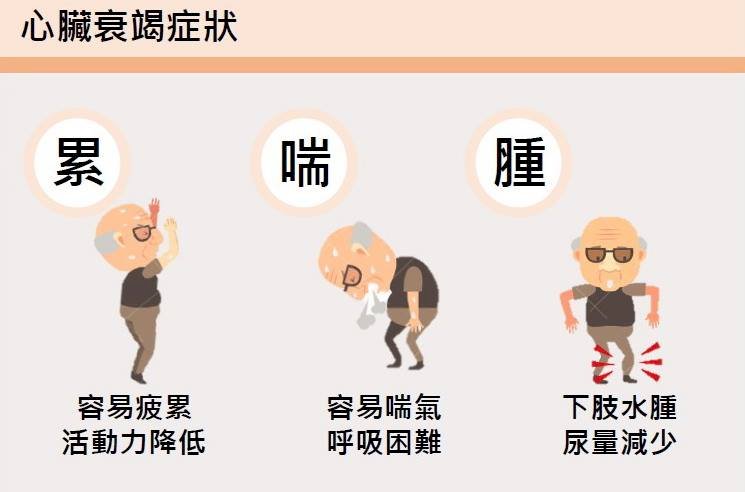 累喘腫 心臟衰竭有徵兆