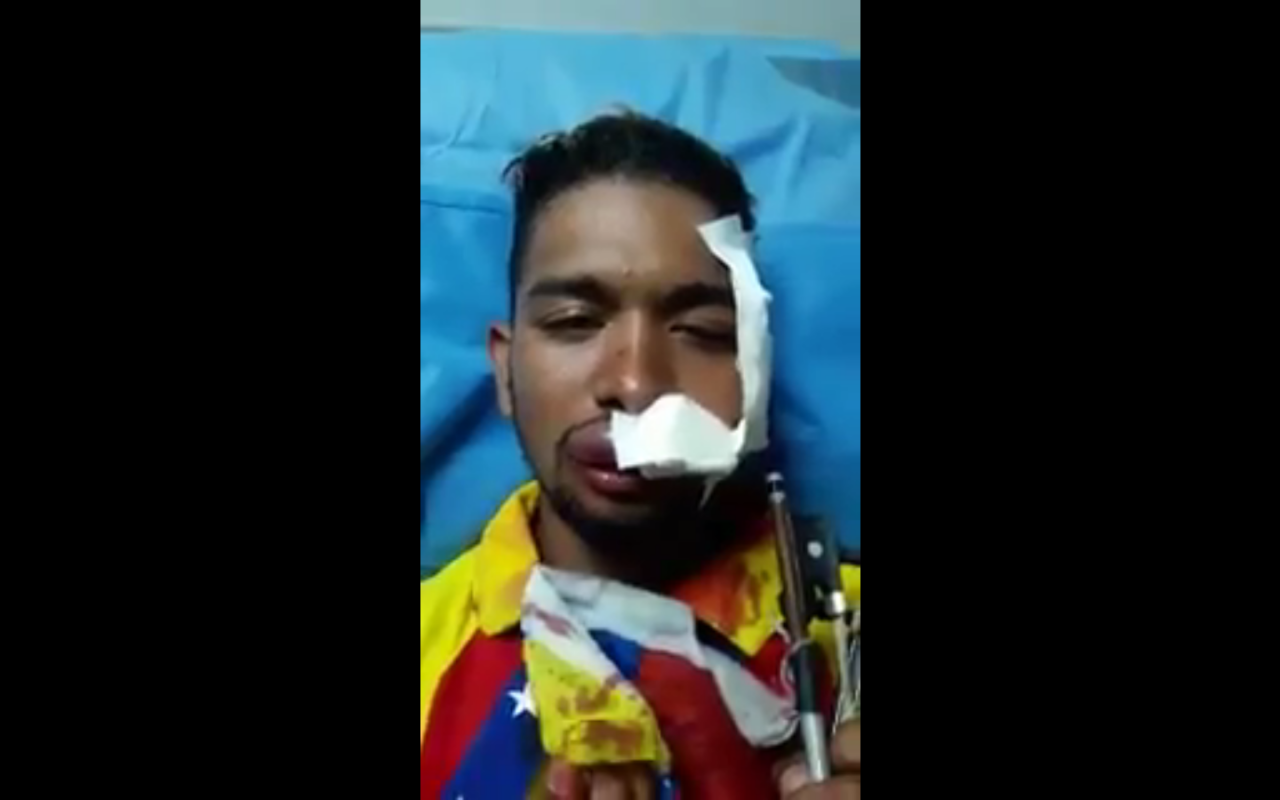 委國再爆衝突  示威代表人物小提琴家受傷
