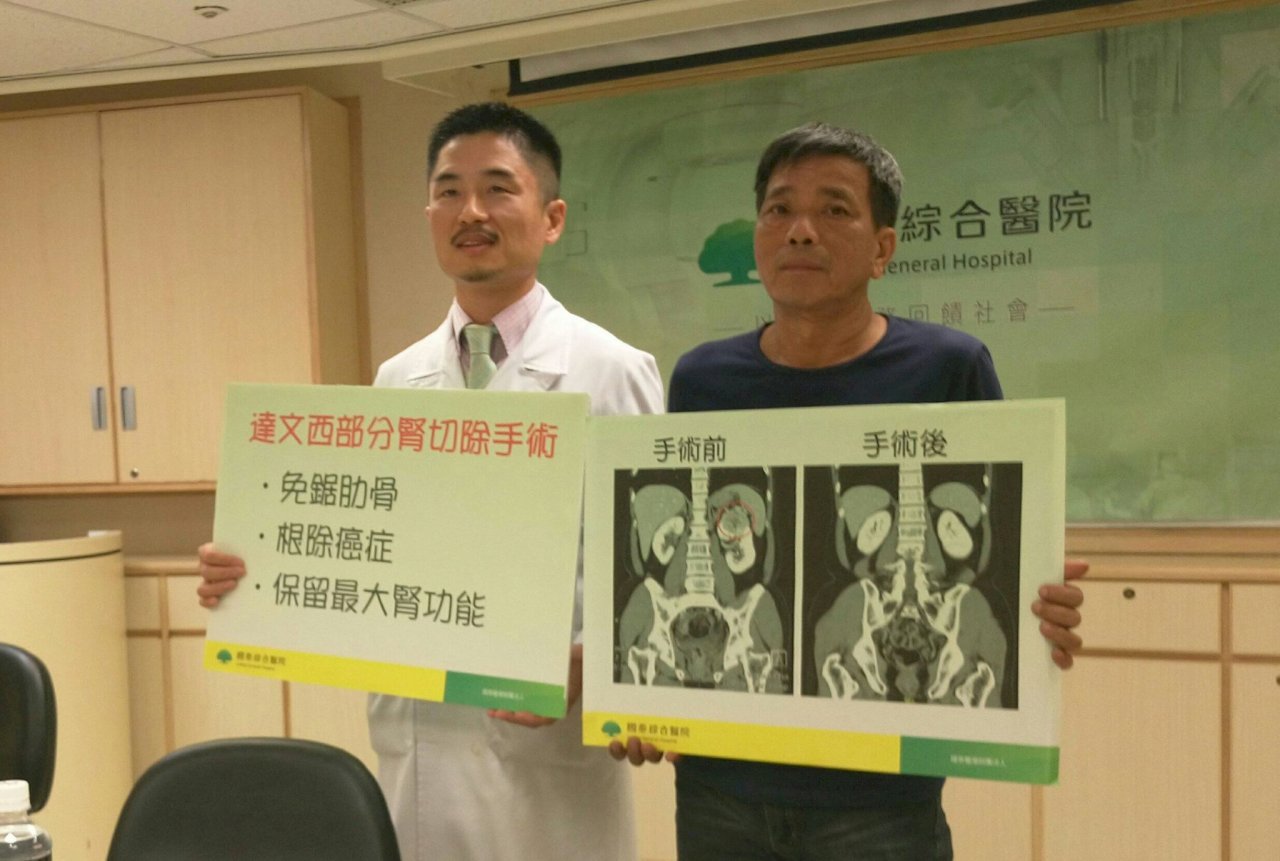 腎臟癌難發現 抽菸是高危險因子