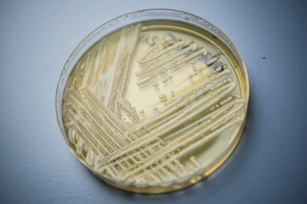 超級黴菌台灣也有 曾出現輕症個案