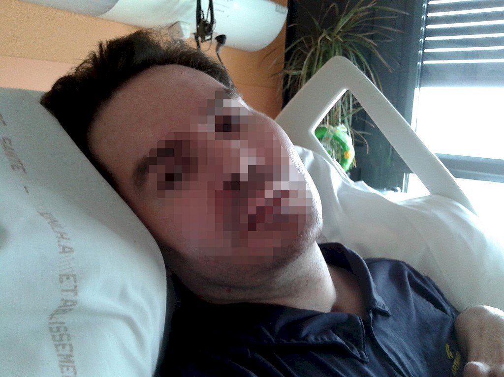 車禍嚴重腦損是否續命吵十年 法植物人拔管走了