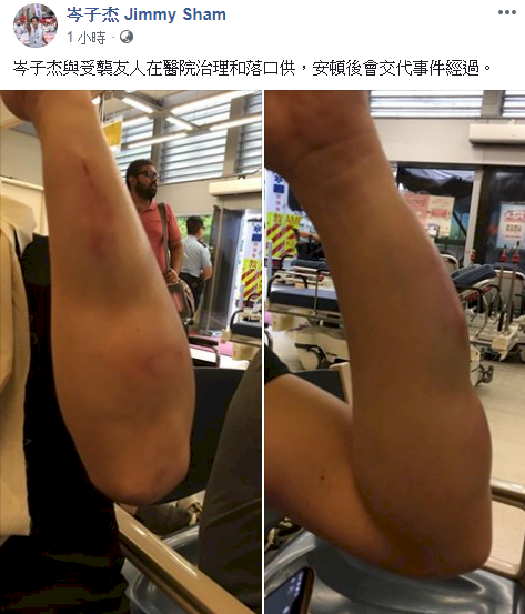 民陣召集人批警方不准遊行 用餐遇襲友人送醫