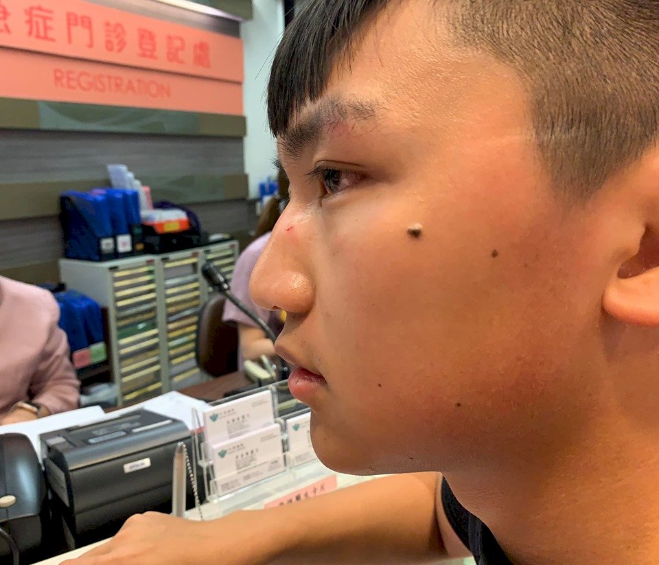 香港眾志副主席鄭家朗遇襲 3男揮拳毆打