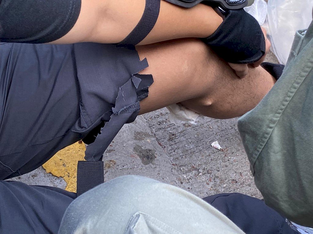 香港理工大學對峙 一名警察小腿中箭