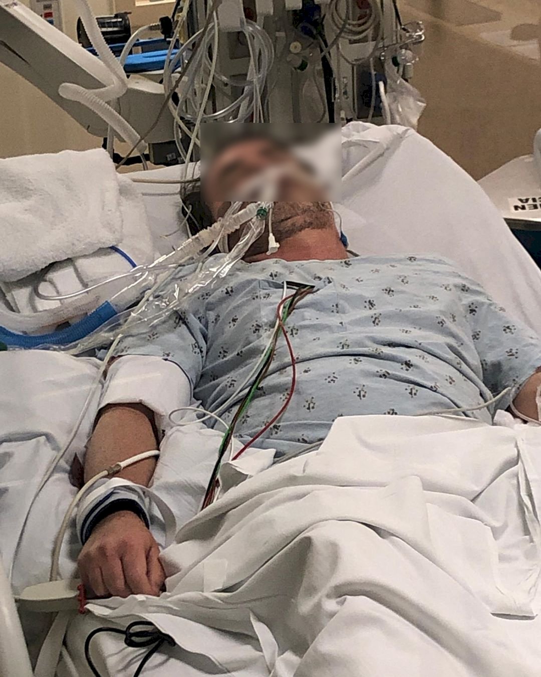 貼朋友插管照 六人行女主角：戴上該死口罩