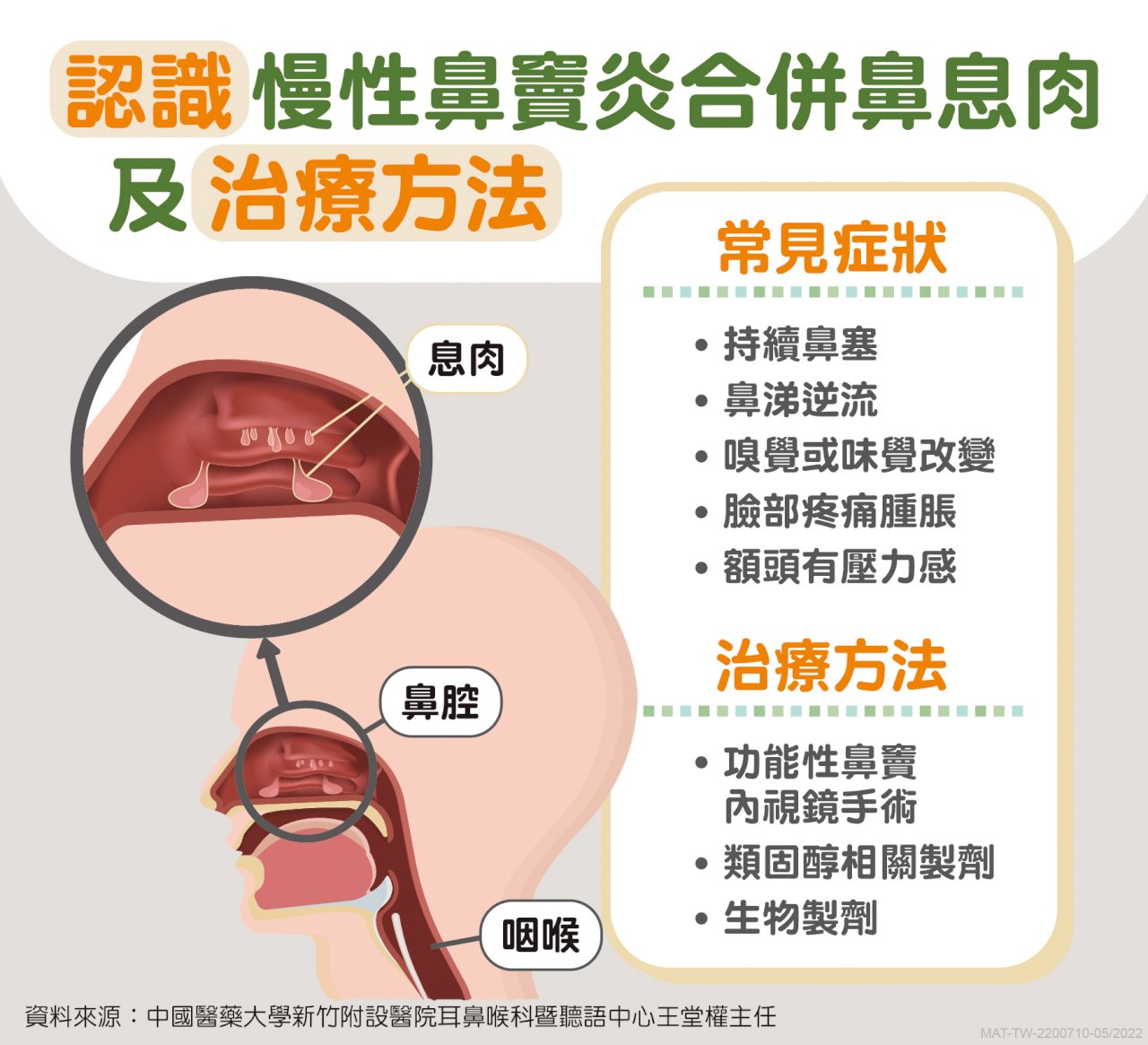 鼻塞、流鼻水、嗅覺異常不一定是染疫 恐是慢性鼻竇炎