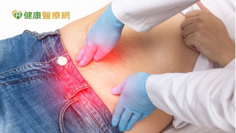 下腹部腫塊勿輕忽！5旬男疝氣險失「腸」