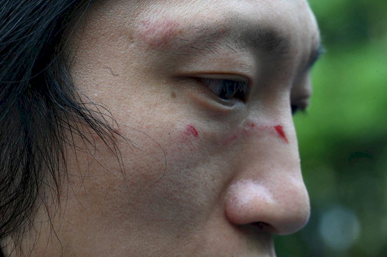 中共二十大／被英警方救出！遭暴打港人還原現場