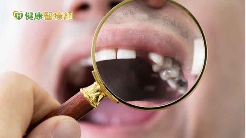 缺牙該植牙還是做假牙？食藥署揭兩者差異