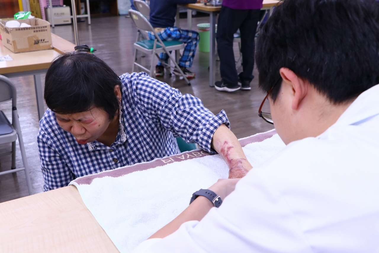 燒傷患者4成未婚離婚喪偶 陽光助生心理重建