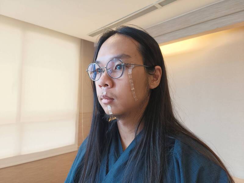 英雄的疤痕！ 中捷「長髮哥」今出院