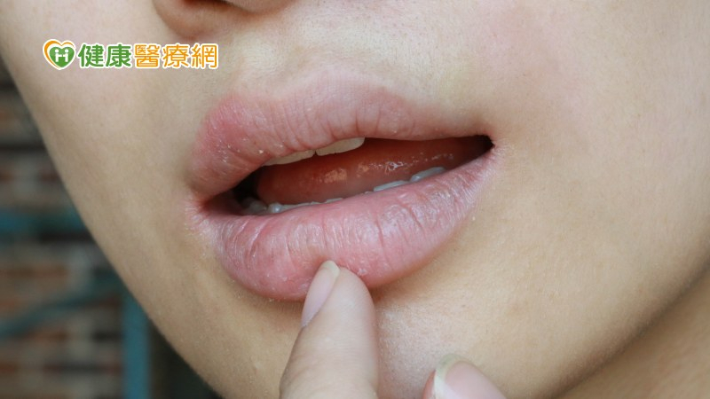 口乾不一定是水喝不夠！可能與「這些」疾病有關