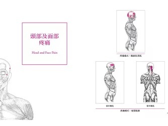 《肌筋膜激痛點自我照護手冊》幫助舒緩疼痛，快速恢復自在活動！