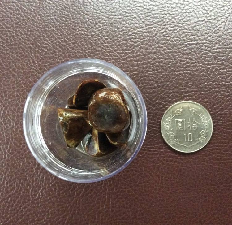 膽結石一定要手術治療嗎？